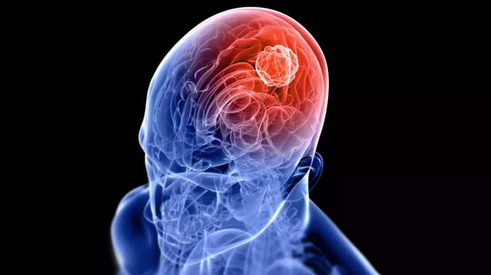 Perubahan Fisik dan Mental yang Tidak Boleh Diabaikan
